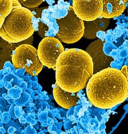 Человеческие белые кровяные клетки (в синем) принимают бактерии Staphylococcus aureus.