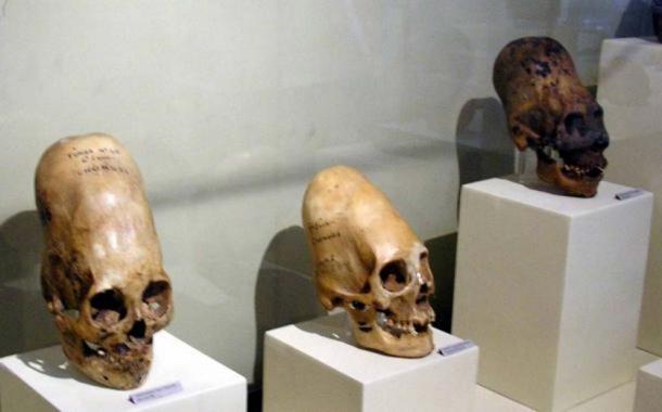 Удлиненные черепа на выставке в Музее Регионального де Ика в городе Ика в Перу
